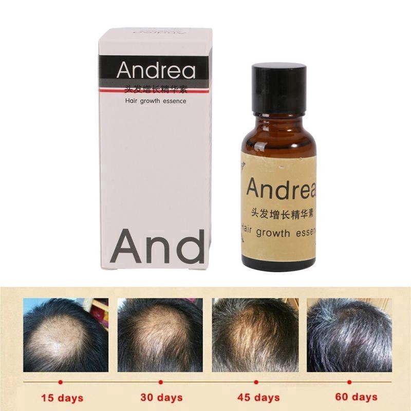[Hàng mới về] Tinh chất kích mọc tóc ANDREA 20ml
