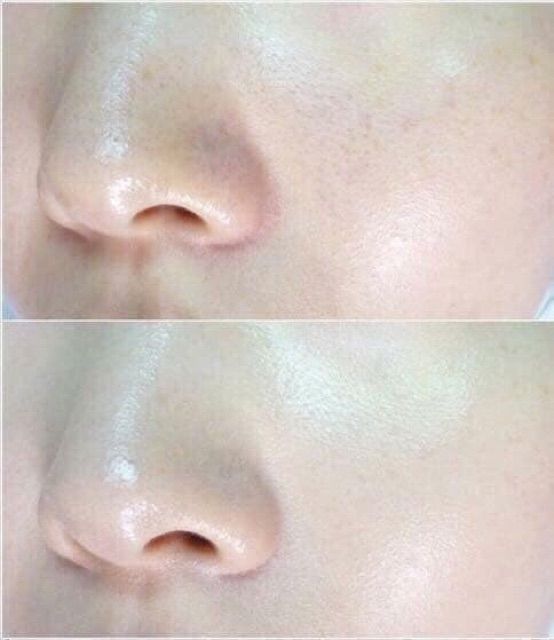 Viên uống trắng đẹp da Collagen Placenta 5 in 1 Nhật | BigBuy360 - bigbuy360.vn