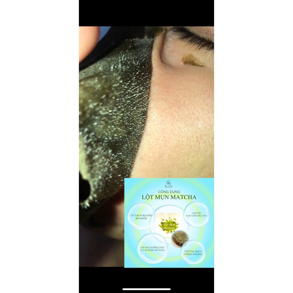LỘT MỤN MATCHA TRÀ XANH | BigBuy360 - bigbuy360.vn