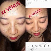 [CHÍNH HÃNG] Serum Dưỡng Mi Siêu Dài Zzvenus [Bản nâng cấp KING VENUS]