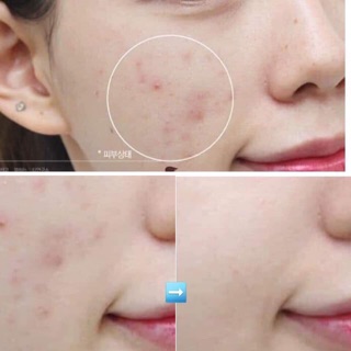 SỮA RỬA MẶT INNISFREE BIJA