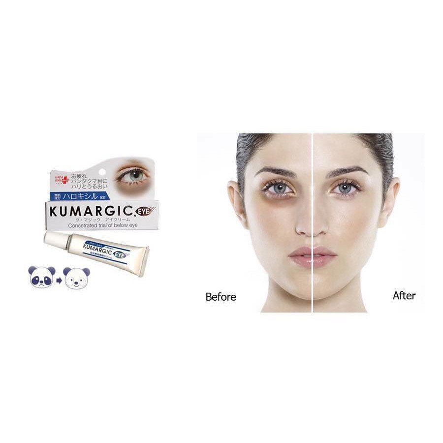 Kem Kumargic Eye 20g của Nhật Hỗ Trợ Cải Thiện Thâm Quầng Mắt