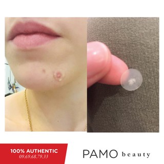 Miếng dán mụn Acne Pimple Master Patch COSRX