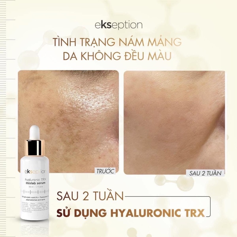 SERUM MỜ THÂM NÁM Ekseption Hyaluronic TRX / NIACIN 50ML