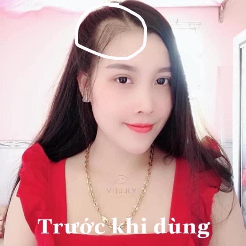 [TẶNG QUÀ] Combo 3 chai tinh dầu bưởi vijully, kích mọc tóc, trị hói