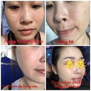 SERUM MEIDUZI NHẬT BẢN