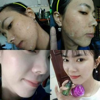 Kem face n collagen