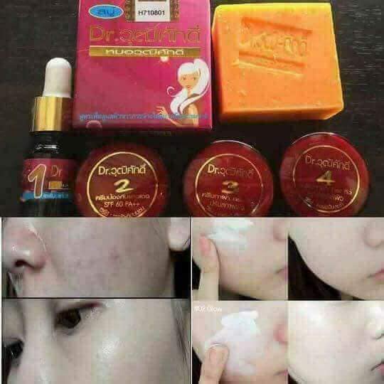 Kem trắng da nám thái