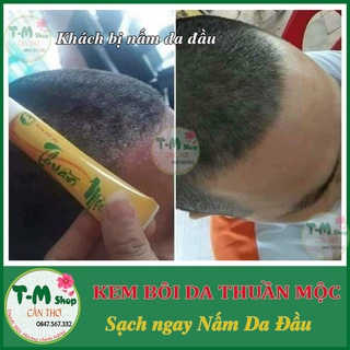 KEM BÔI DA LIỄU