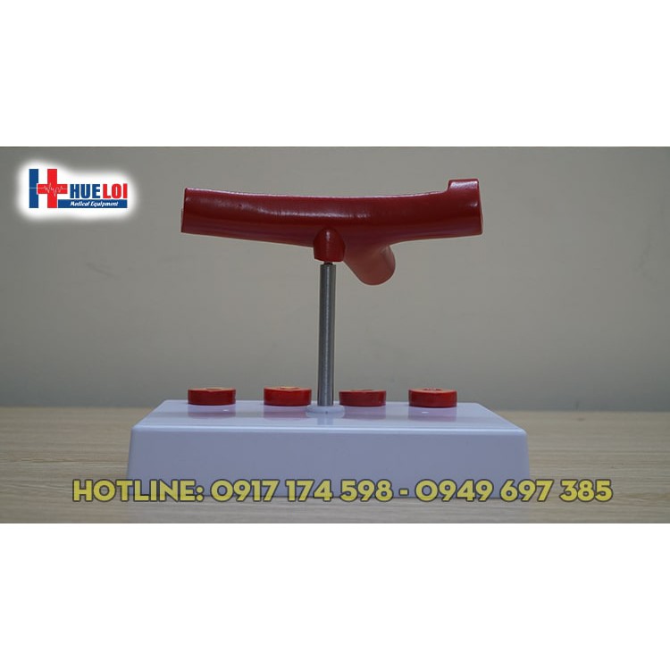 Mô hình huyết khối kèm  xơ vữa động mạch vành