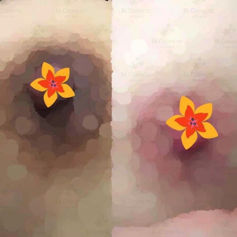 Kem dưỡng hồng nhũ hoa & bikini | BigBuy360 - bigbuy360.vn