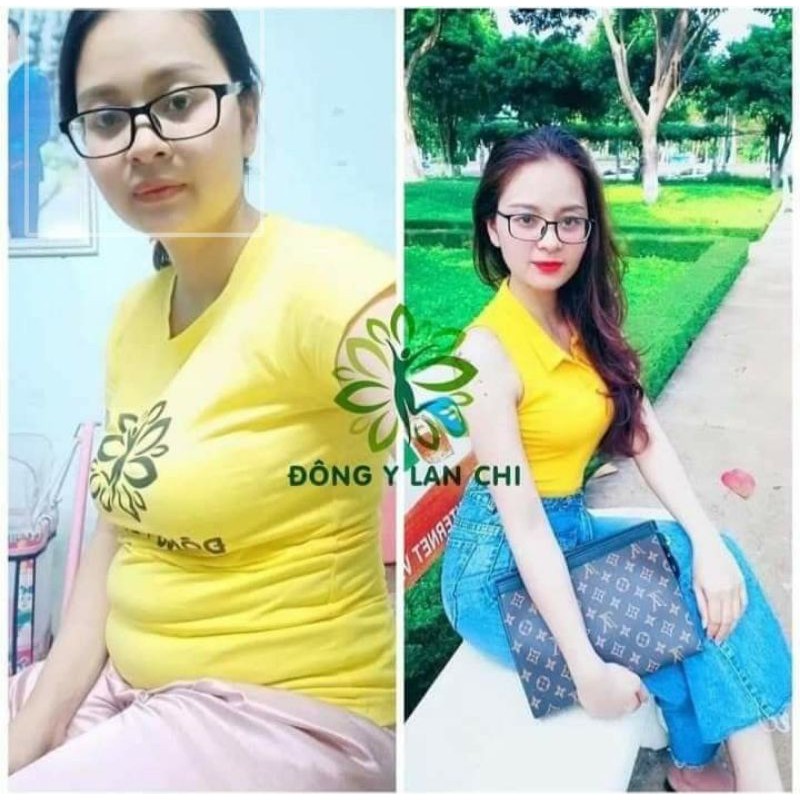 viên uống thảo mộc lan chi slim