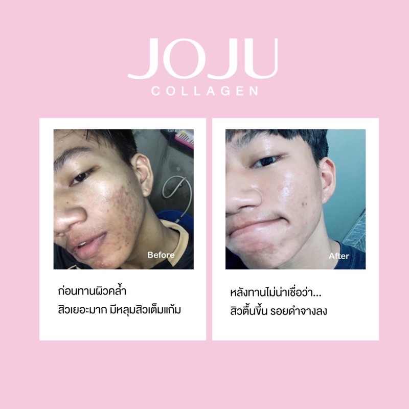 Viên uống duỡng da sáng khoẻ JOJU Collagen