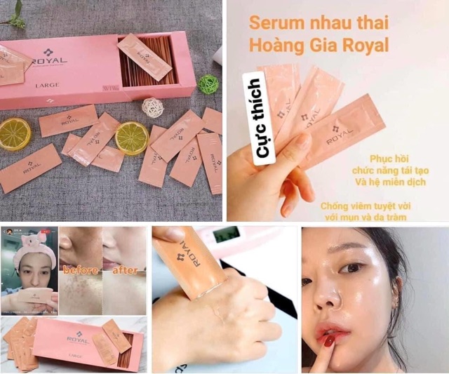 [Chính Hãng] Serum nhau thai cuống rốn Royal Nhật Bản