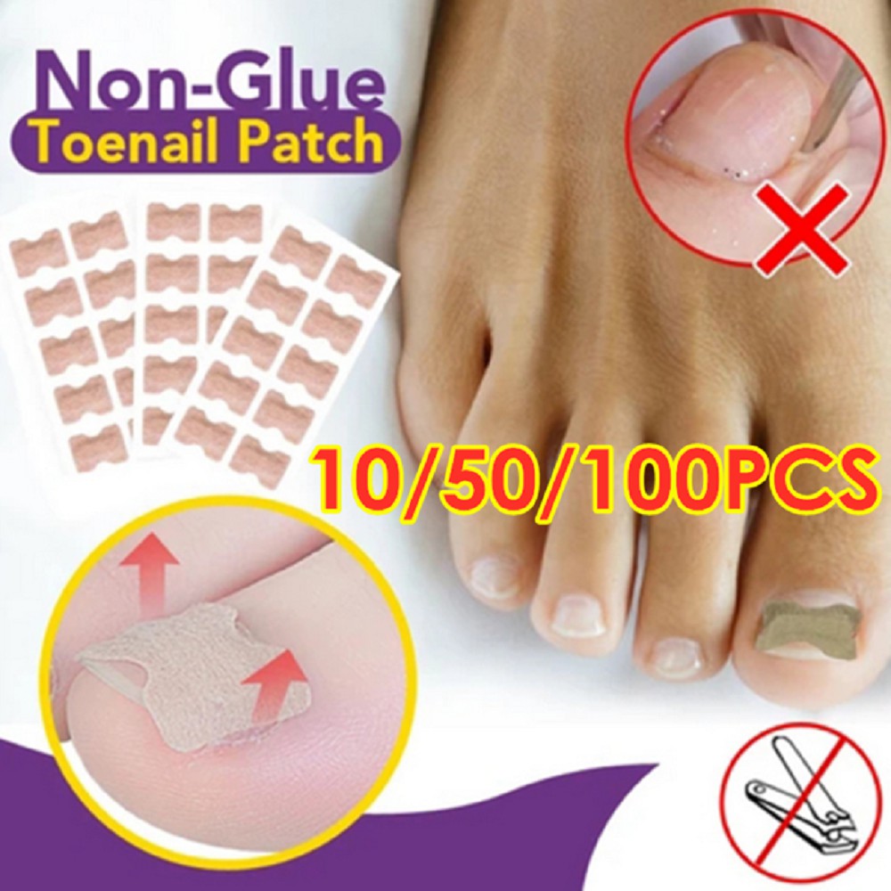 10PCS Non-Glue Toenail Patch Ingrown Toenail Correction Pedicure Tool