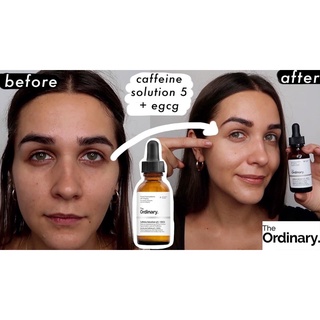 𝐓𝐡𝐞 𝐎𝐫𝐝𝐢𝐧𝐚𝐫𝐲 𝐂𝐚𝐟𝐟𝐞𝐢𝐧𝐞 𝐒𝐨𝐥𝐮𝐭𝐢𝐨𝐧 𝟓% + 𝐄𝐆𝐂𝐆