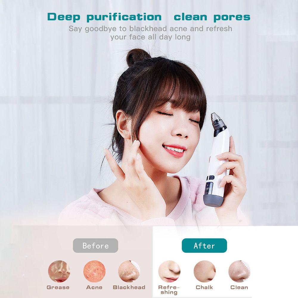 Máy Hút Mụn Đầu Đen Làm Sạch Sâu Cho Mũi