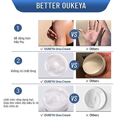 Kem dưỡng ẩm Oukeya Anti-Cracked Skin Repair Urea Cream