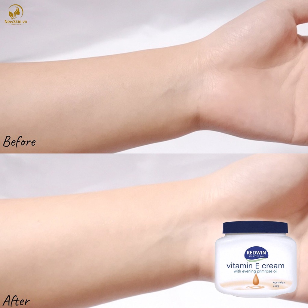 Kem dưỡng da mềm mịn Redwin Vitamin E Cream từ thiên nhiên (300g)
