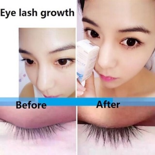 Serum Dưỡng Dài Lông Mi Trong 7 Ngày Miraclash