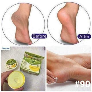 Kem chuyên trị nứt gót chân của Thái Lan. Banana