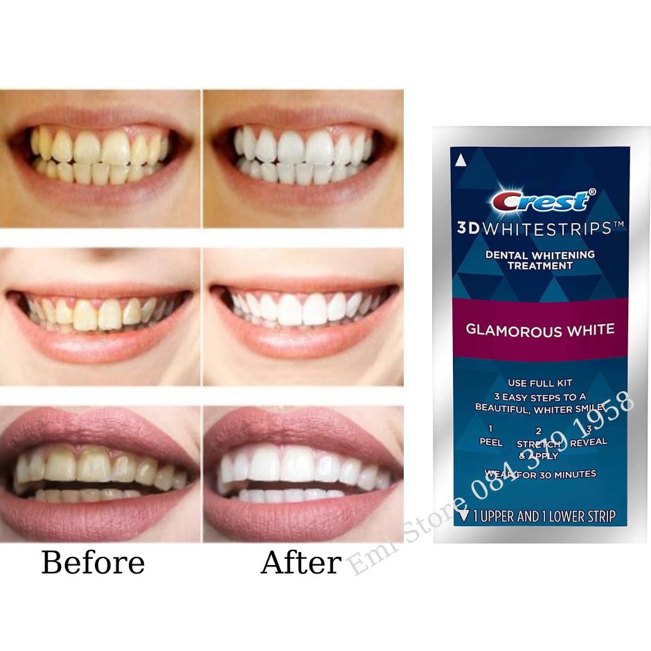 Miếng dán trắng răng Crest 3D White -  Chính Hãng Mỹ - Răng trắng sáng, an toàn cho men răng