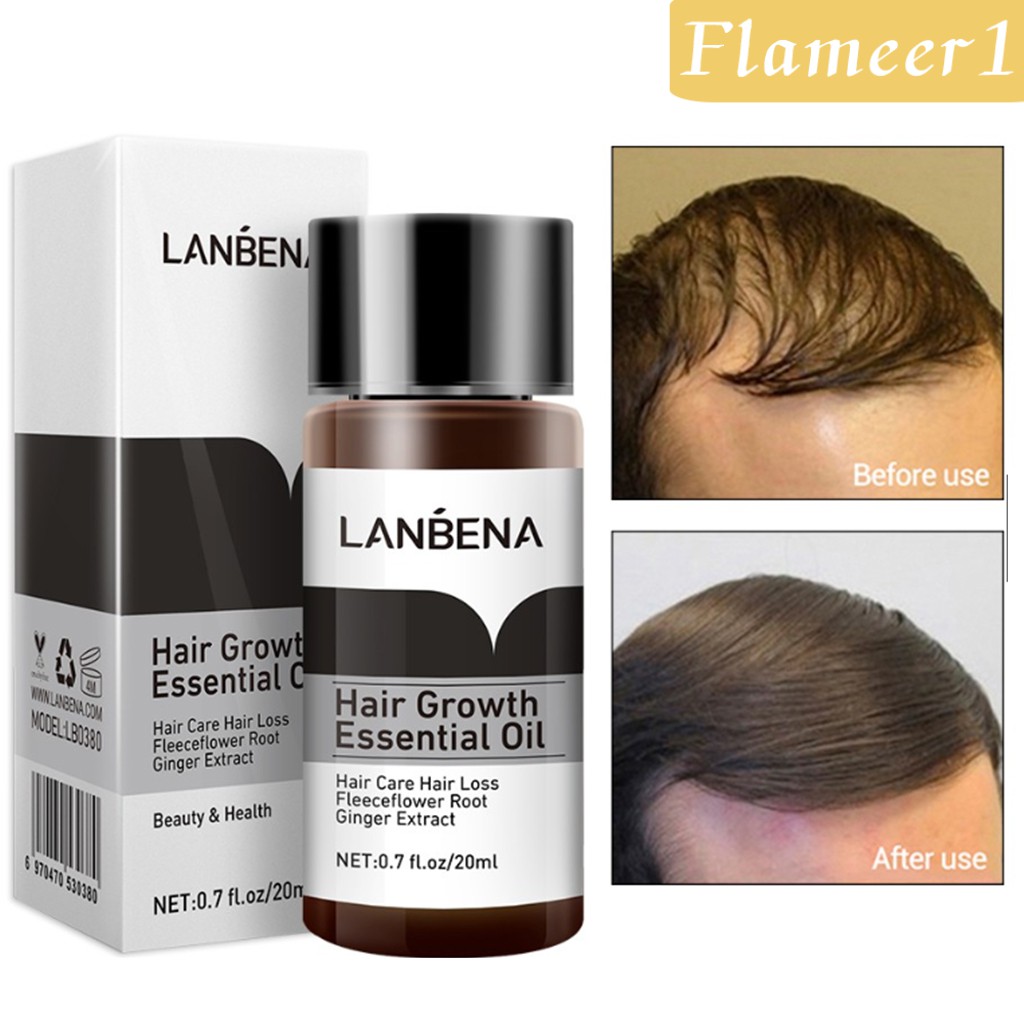 [Hàng mới về] Serum tinh dầu kích thích mọc tóc ngăn ngừa rụng tóc dành cho nam và nữ