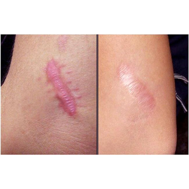 Kem sẹo Gentacin Nhật Bản 10gr️️ chính hãng | BigBuy360 - bigbuy360.vn