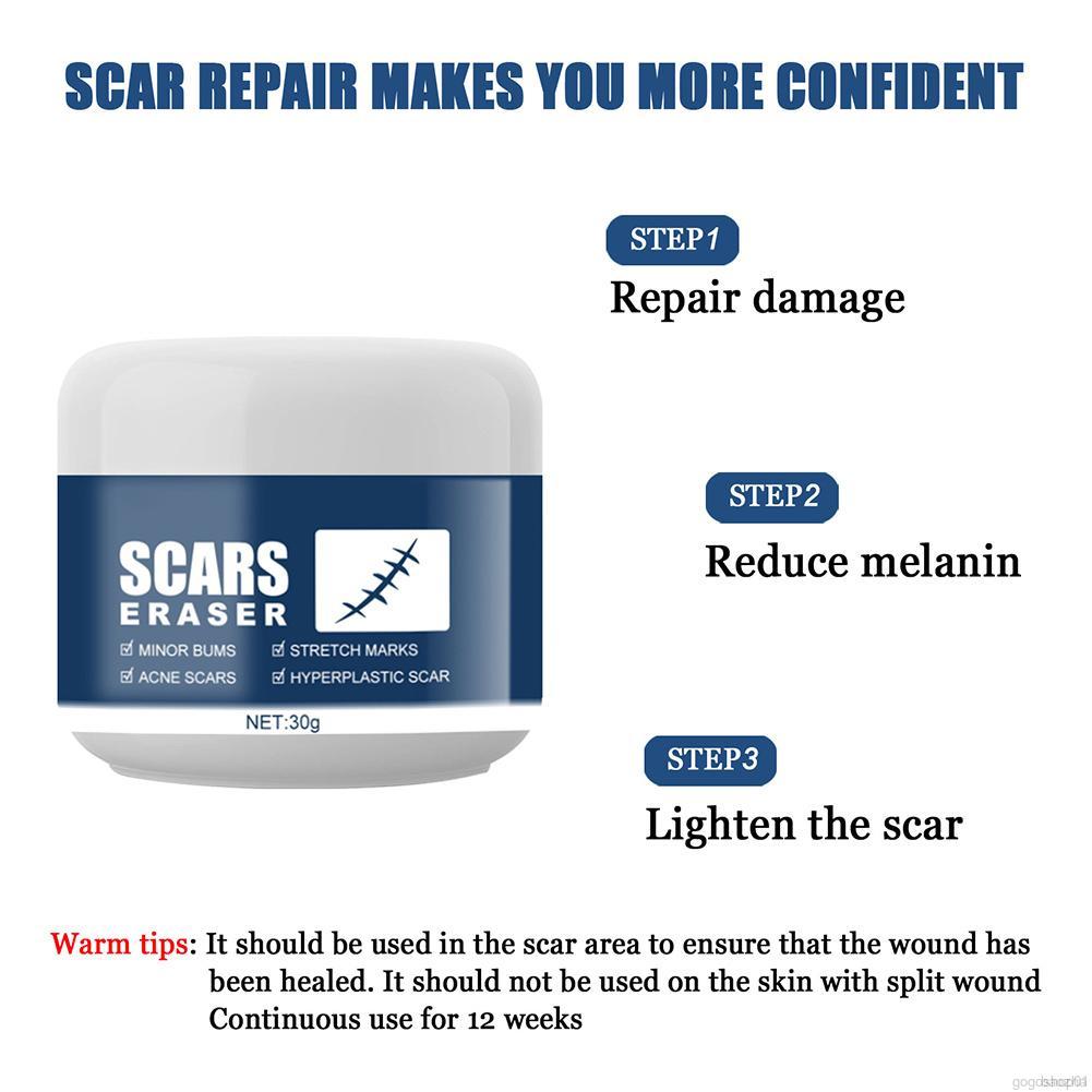 Multi-effect Scar Acne Cream Pimple Treatment Cream Scar Removal Cream- Stretch Marks Remover Cream For All Skin Types, New And