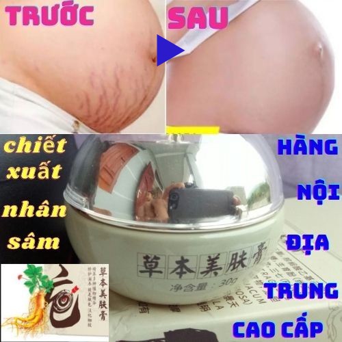 Kem Làm Mờ Rạn Da Mẹ Bầu và Sau Sinh “Nhân Sâm” Cao Cấp, Nội Địa Trung 30gr.
