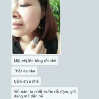 Bột đắp mặt