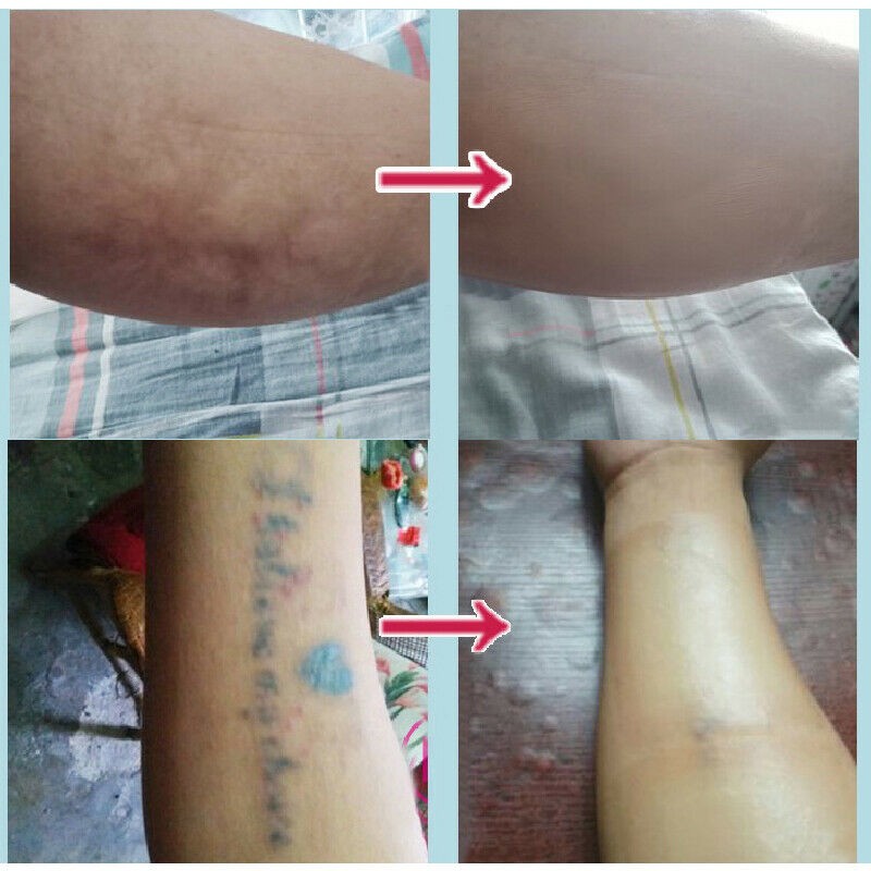 [Hàng mới về] Miếng dán che khuyết điểm/hình xăm chuyên dụng tiện lợi | BigBuy360 - bigbuy360.vn