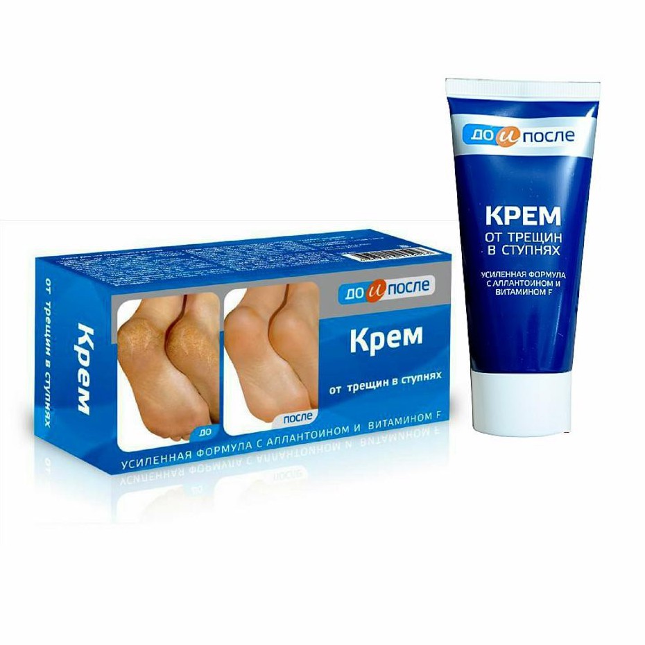 🍀🍀Kem Trị Nứt Gót Chân Kpem Apteka Nga - 50ml