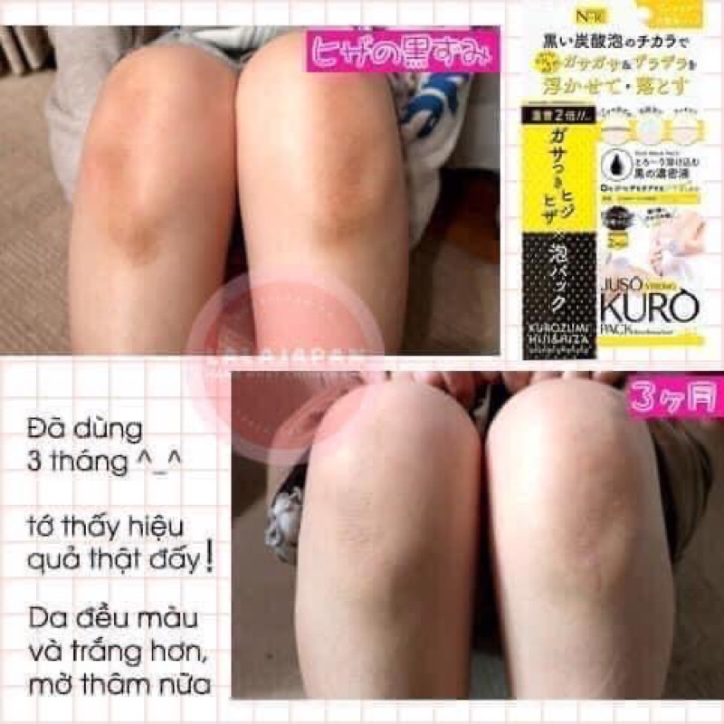 Gel xịt Juso Kuro Nhật Bản giảm thâm cùi chỏ, đầu gối, nách giúp tẩy da chết tế bào chết