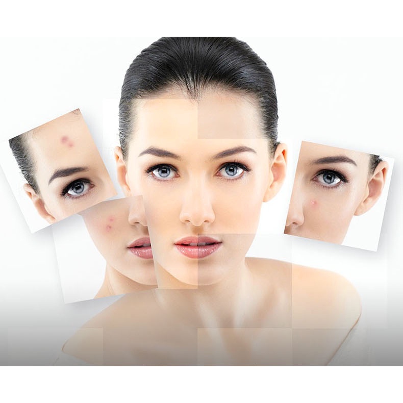 Mặt nạ dưỡng ẩm kiểm soát dầu thu nhỏ lỗ chân lông