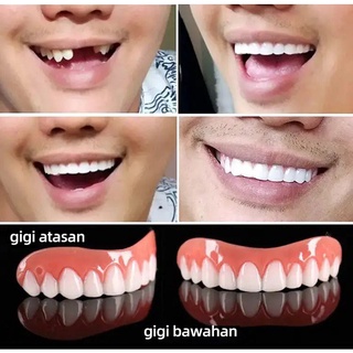 Răng giả niềng răng chất lượng cao