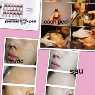 vi kim tảo biển giảm 30%