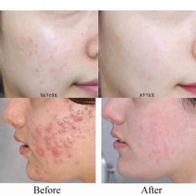 Sữa Rửa Mặt Tinh Chất Nghệ Neutro.Genna 150ml | BigBuy360 - bigbuy360.vn