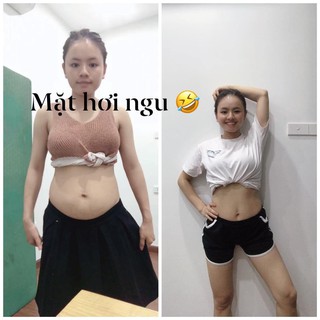 Tinh chất nhỏ rốn Nitiny