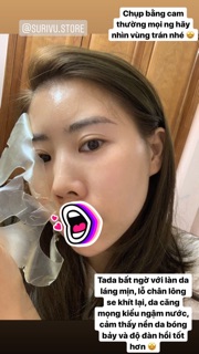 MẶT NẠ NÂNG CƠ - CĂNG DA DERM-ALL MATRIX