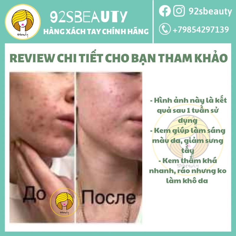Kem bôi giảm mụn Sos Nga Propeller giúp gom cồi mụn, giảm sưng mụn