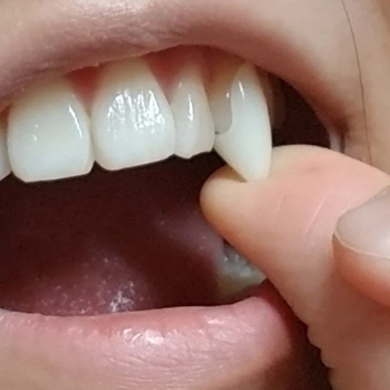1 Cặp Răng Nanh Giả Hóa Trang Ma Cà Rồng Cho Lễ Halloween