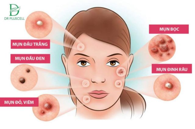 Tế bào gốc mụn  Dr Pluscell_ Cam kết hàng chính hãng | BigBuy360 - bigbuy360.vn
