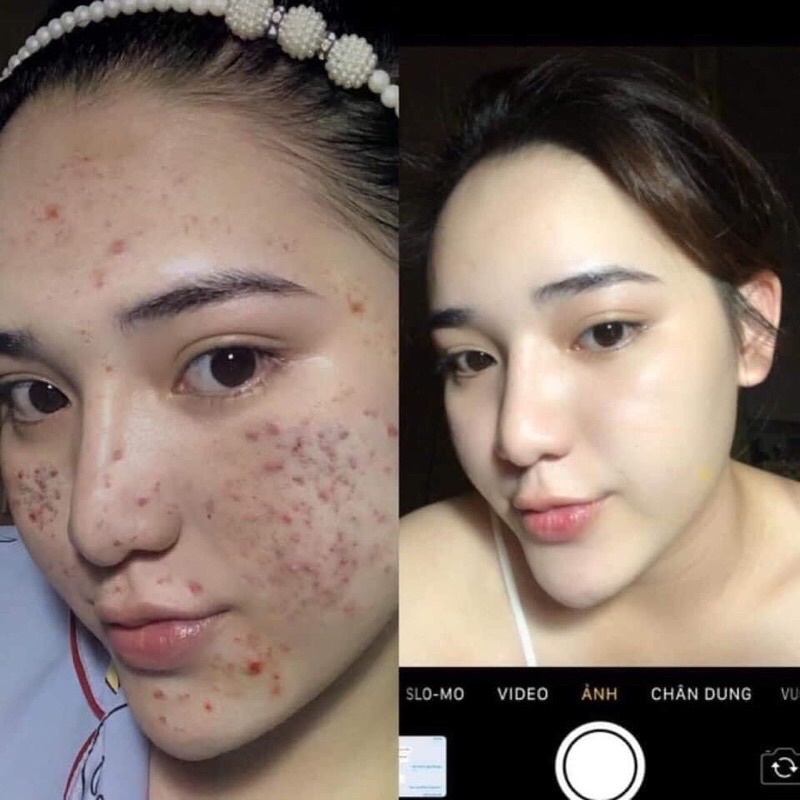 Cao sâm đỏ 36 vị thuốc bắc hũ to 15g hũ lớn date mới 100% chính hãng