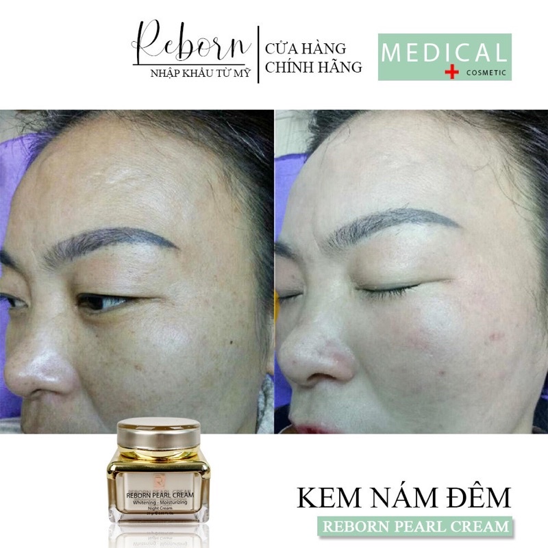 Kem Nám Đêm Reborn Dưỡng Trắng Dành Cho Da Nám_25gr
