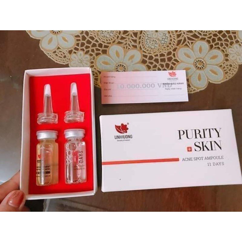 Đánh bay nốt mụn xấu xí cùng vua trị mụn Linh Hương (purity skin)