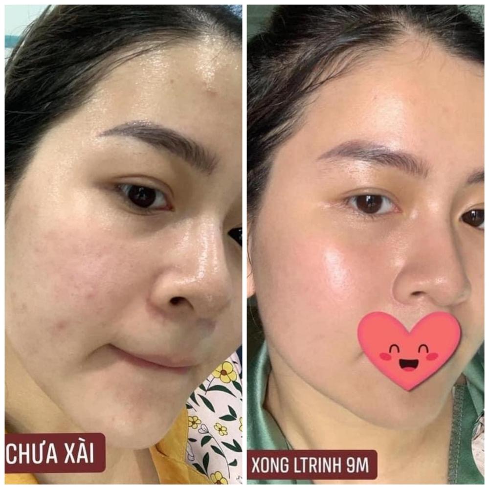 Mặt Nạ Retinol Mask E&G Beauty, Trắng Sáng Da Căng Bóng, Mask Chống Lão Hóa, Tái Tạo Da 25g - Hộp 3 Miếng