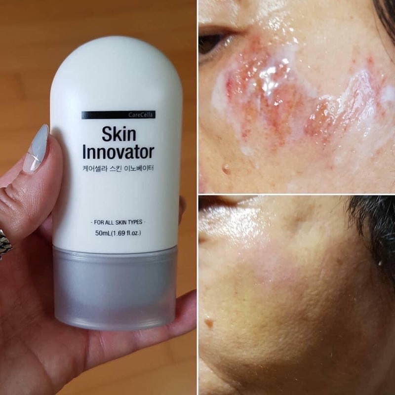 Gel tái tạo Skin Innovator Carecella