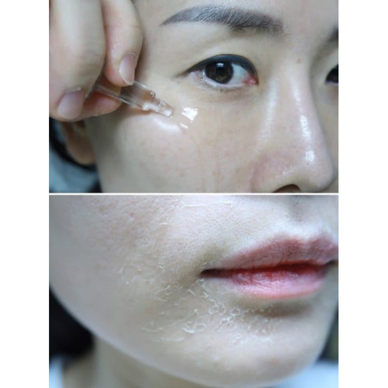 VI TẢO THAY DA SINH HỌC QSCELL