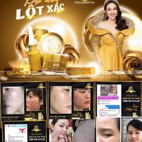 Serum Đông Anh Collagen X3 tinh chất giảm thâm nám, giữ ẩm, căng bóng da mặt